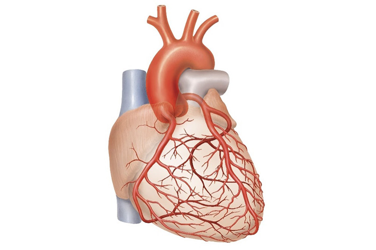 狭心症のイメージ