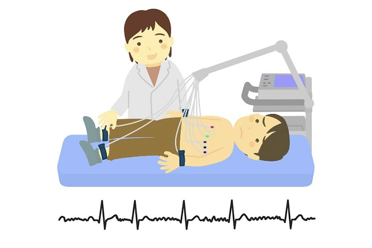 12誘導心電図検のイメージ