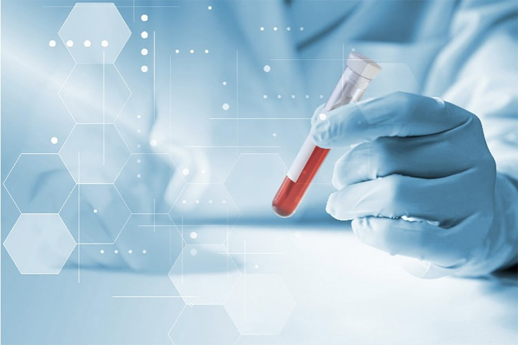 血液検査のイメージ