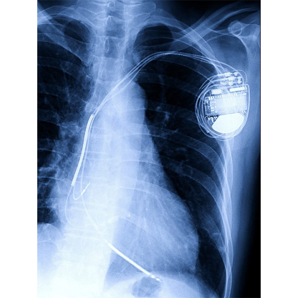 レントゲン写真のイメージ