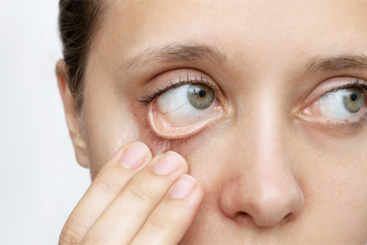 貧血のイメージ