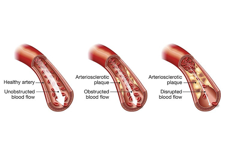 内皮細胞のイメージ