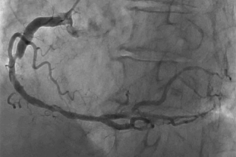 X線撮影のイメージ