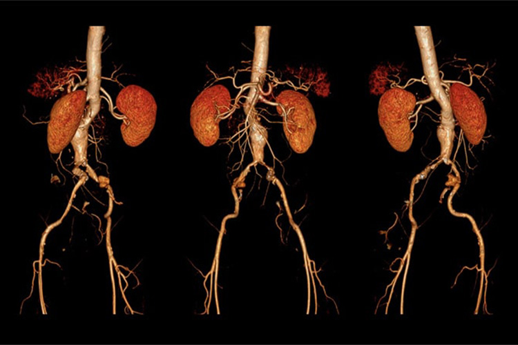 造影CT検査のイメージ