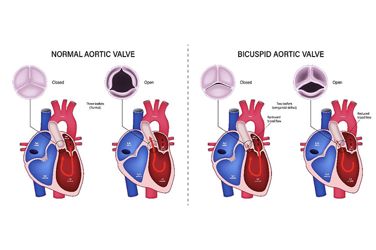 弁の異常のイメージ