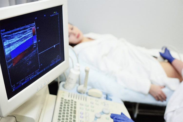 動脈エコー検査のイメージ