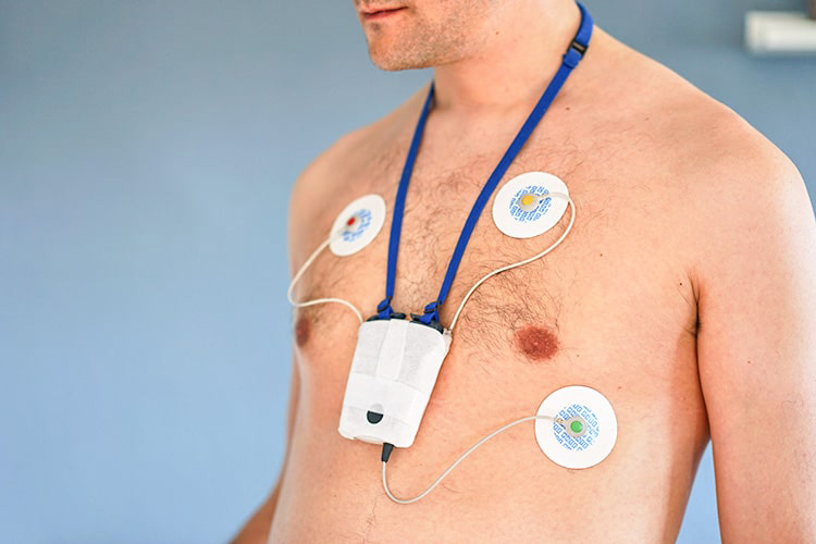 ホルター心電図のイメージ写真