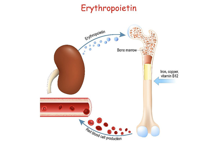 腎性貧血のイメージ