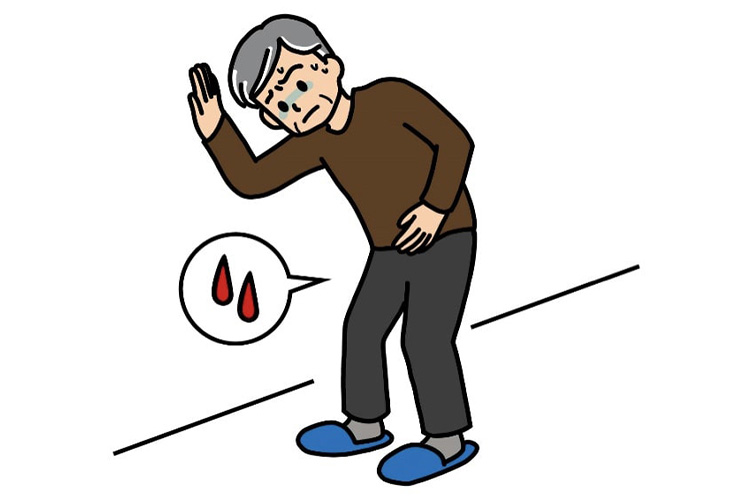 膀胱のイメージ