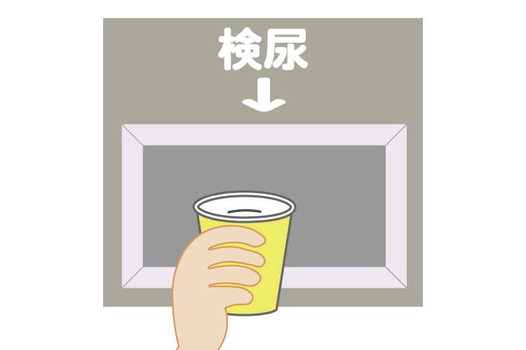 検尿のイメージ