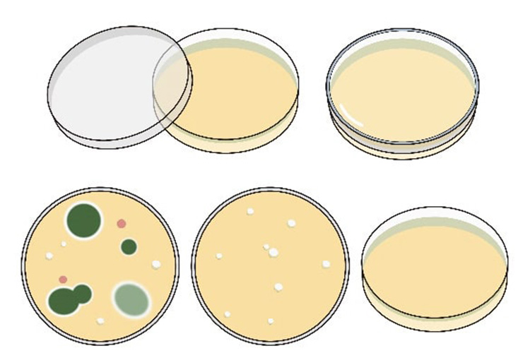 尿培養検査のイメージ
