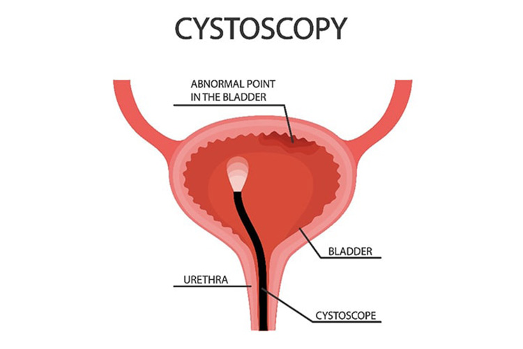 超音波検査のイメージ