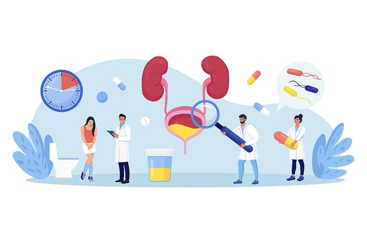 膀胱の治療のイメージ