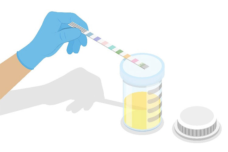 尿検査のイメージ