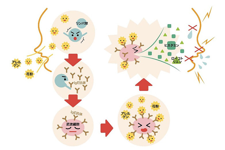 花粉症のイメージ