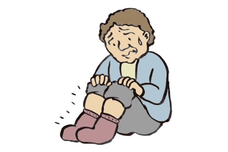 体静脈のうっ血症状のイメージ