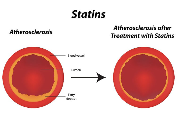運動療法のイメージ