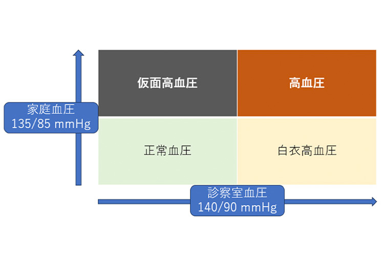 高血圧のイメージ