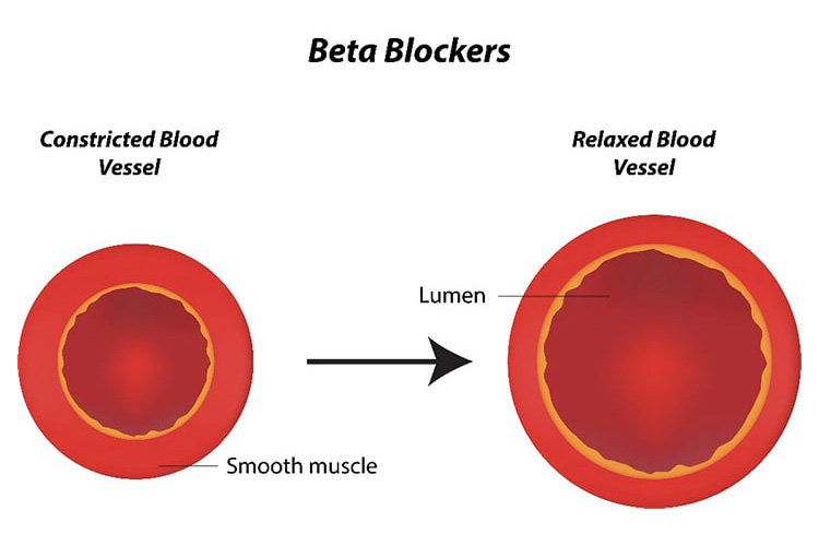 β遮断薬のイメージ