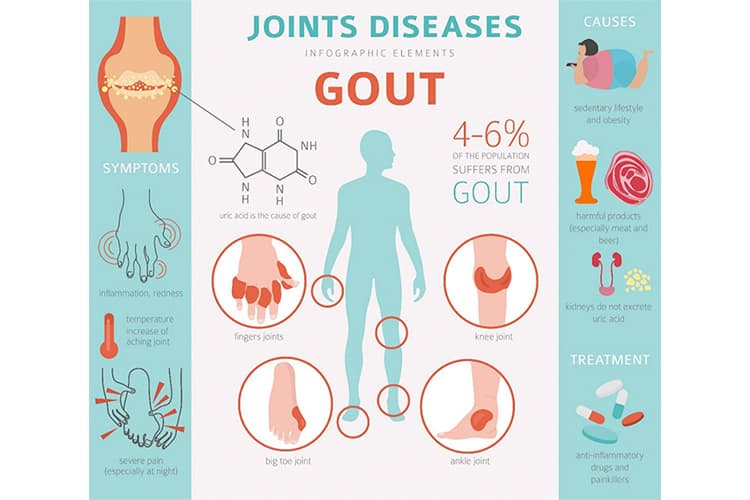 痛風のイメージ