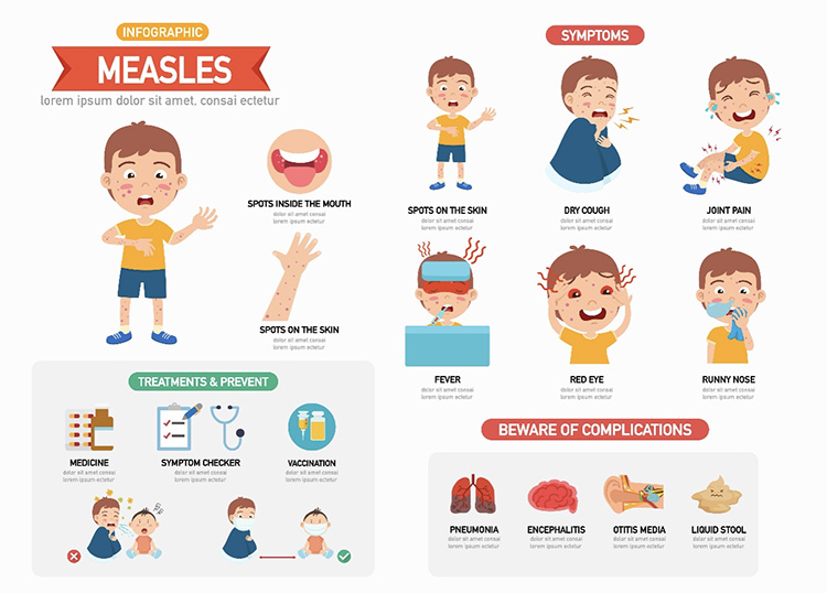 麻疹のイメージ