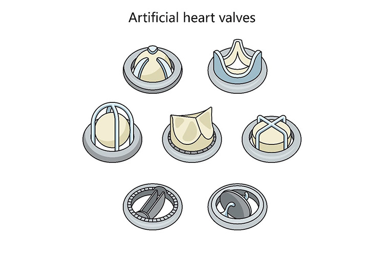人工弁のイメージ
