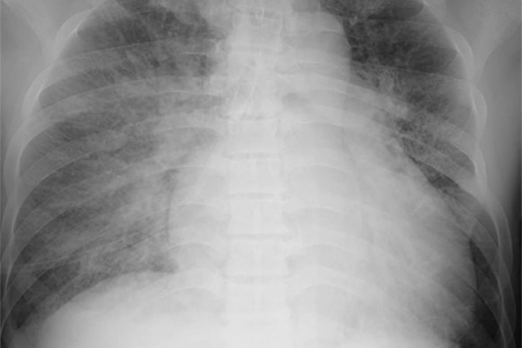 レントゲンのイメージ