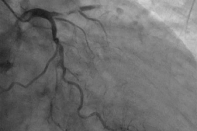 レントゲンのイメージ